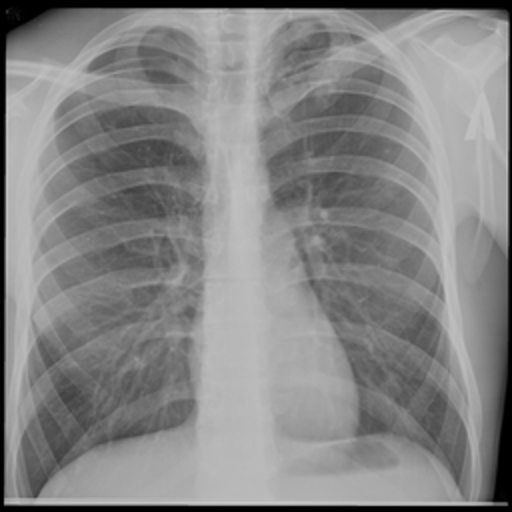 Moderate risk X-ray